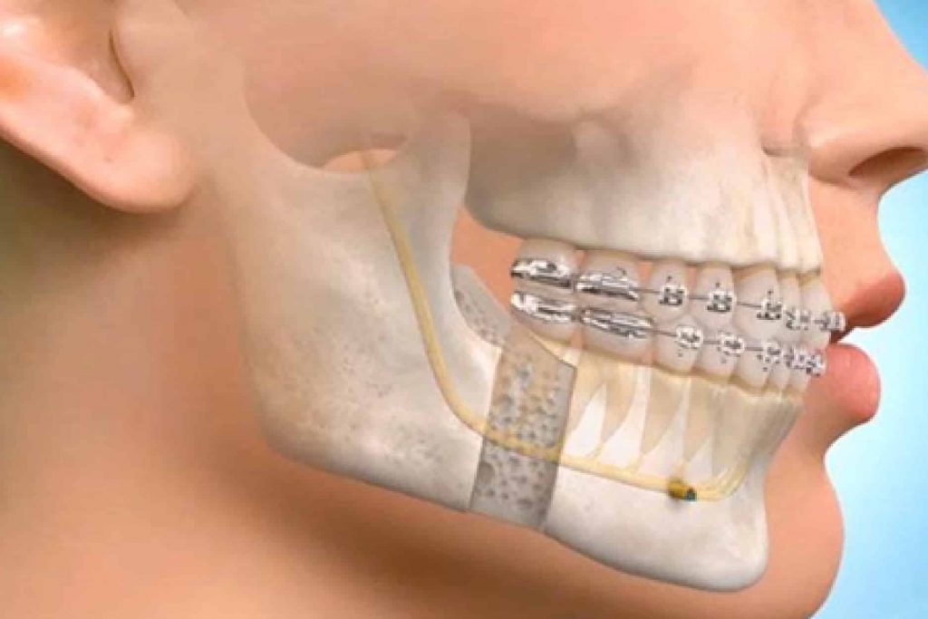 Professional Oral & Maxillofacial Surgeries at Root Care Dental Clinic
