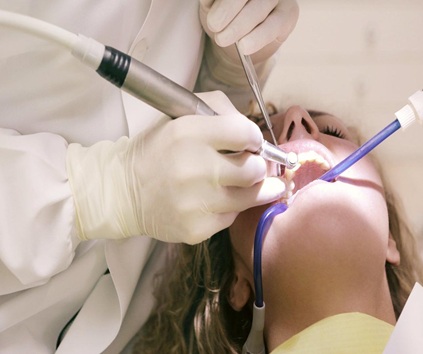Root Canal Procedure